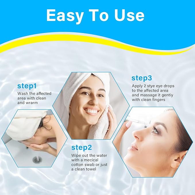 Stye Eye Treatment, Natural Stye Treatment Serum for Styes Chalazion and Blepharitis, Mild & Fast Relief