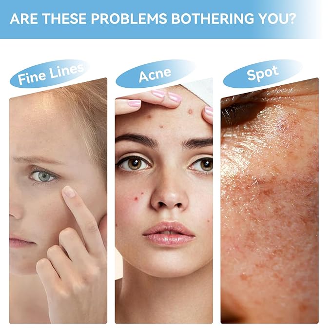 10% Niacinamide + 1% Zinc Face Serum, Nourishing & Refreshing Facial Serum ， Women Serum for Oil Control and Acne 30ML/1 Fl Oz