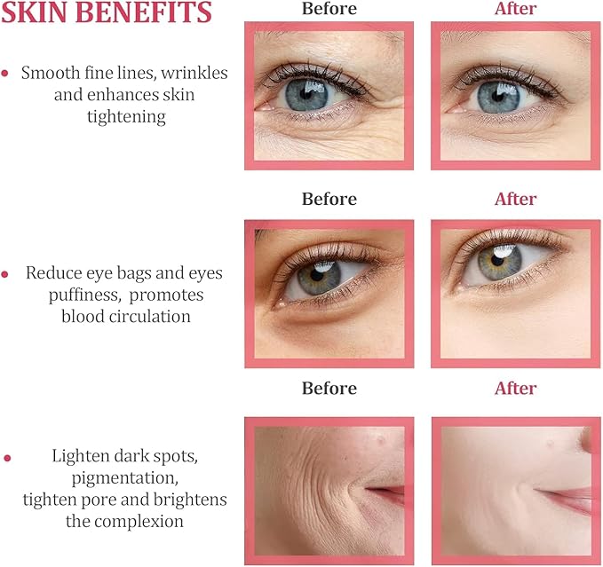 Ice Roller for Face, Ice Cube Facial Roller Massager, Reusable Silicone Face/Neck Ice Mold for Naturally Skin Care, De-Puff Eye Bags, Reduce Migraine Pain