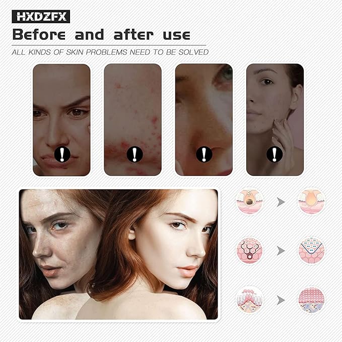 LED FACIAL LIGHT THERAPY MASK(HK207)