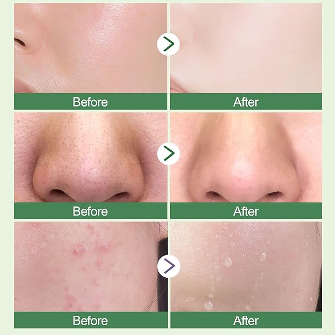 Green Tea Purifying Clay Face Mask, Blackhead Remover With Green Tea Extract, Face Moisturizing，Deep Pore Cleansing for All Skin Types of Men And Women (1 PCS)