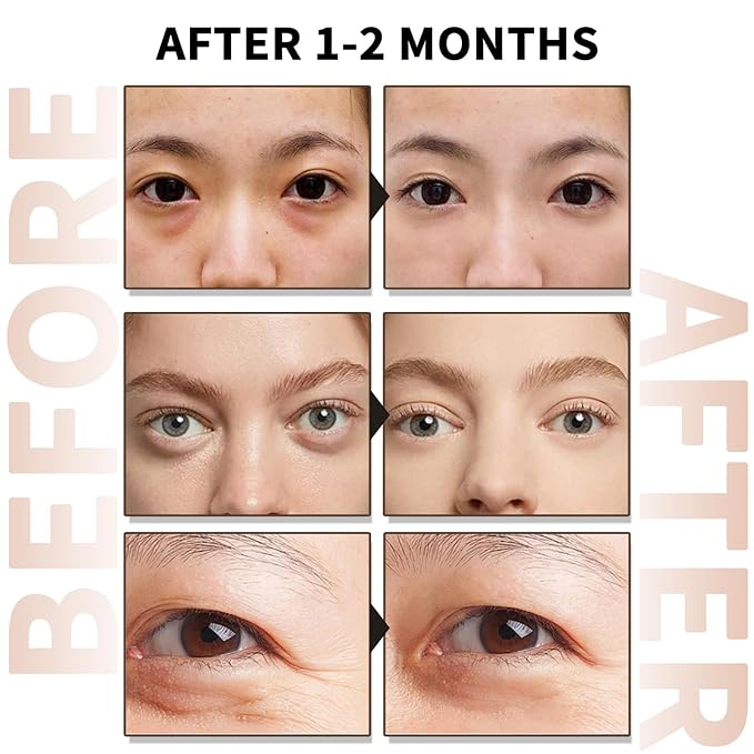 Caffeine Eye Serum With EGCG For Dark Circles and Puffiness, 30ML Anti Aging 5% Caffeine Solution For Puffy Eyes, Fine Lines, Moisturizing Under Eye Serum.