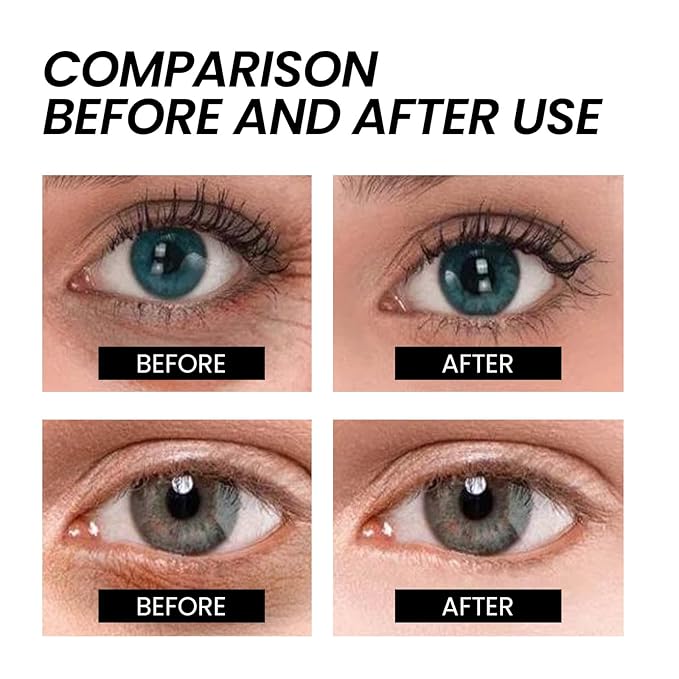 Instant Firming Eye Cream for Under-Eye Bags, Dark Circles & Puffiness–Anti-Aging Eye Tightener to Smooth Fine Lines, Brighten Skin Reduce Wrinkles (1)