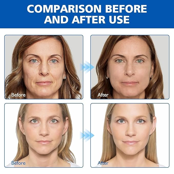 West Month Firming Facial Serum, Skincare Stock Solution, Stock Solution Facial Serum, Reduce Fine Lines Skin-Smooth Looking Skin, Deep Wrinkle Repair Serum, Suitable for All Skin Types(2PCS)