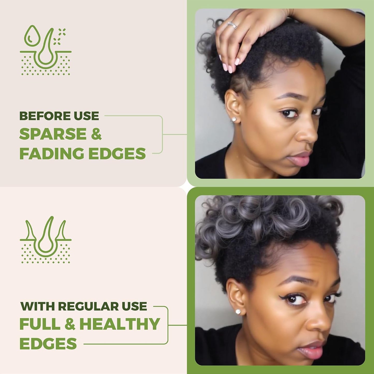 Premium Batana Oil for Hair Growth Blend -100% Natural Batana from Honduras, Castor & Rosemary Oil to Stimulate Hair Growth - Botana, Aceite De Batana - Natural Hair Products for Women & Men