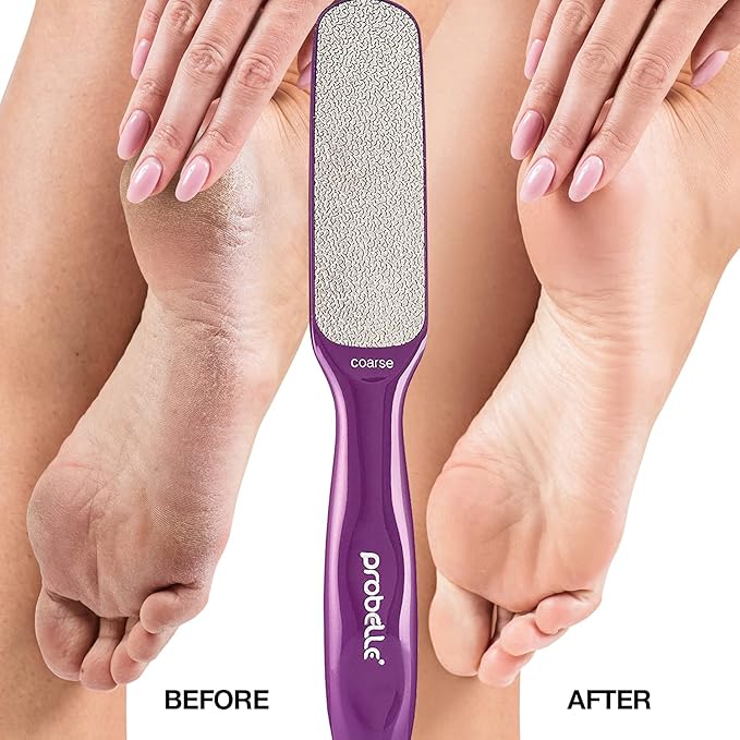 Probelle Double Sided Multidirectional Nickel Foot File Callus Remover - Immediately Reduces calluses and Corns to Powder for Instant Results, Safe Tool (Purple)