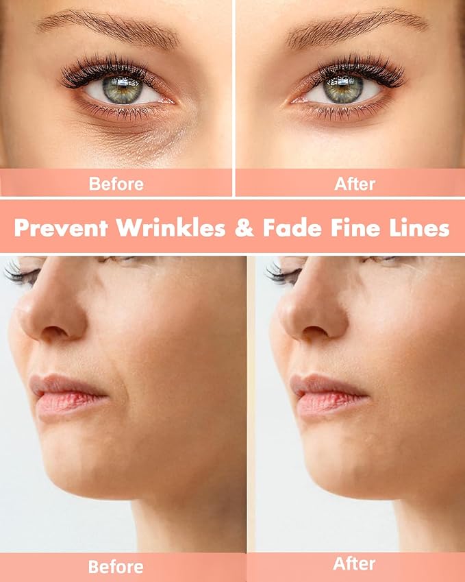 Reusable Eye and Smile Line Patches - 4 Pairs Silicone Under Eye Patches and Nasolabial Folds Patches, Reusable Eye Mask, Silicone Wrinkle Patches, No Adhesive, with Metal Eye Massager, Tin Case