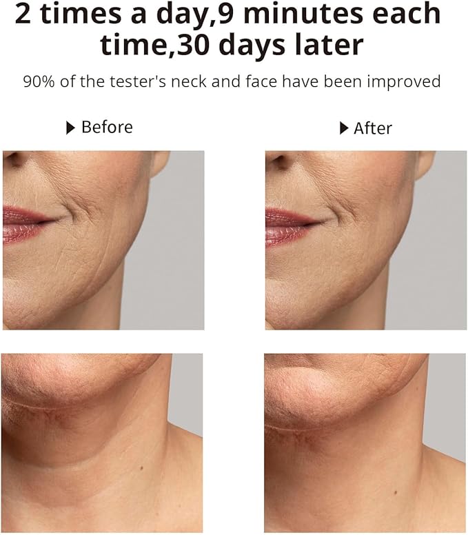 Ms.W Red Light Neck Face Massager, Facial Massager with Hot & Cold Modes for Skin Care, Vibration for Skin Tightening and Rejuvenation（White）