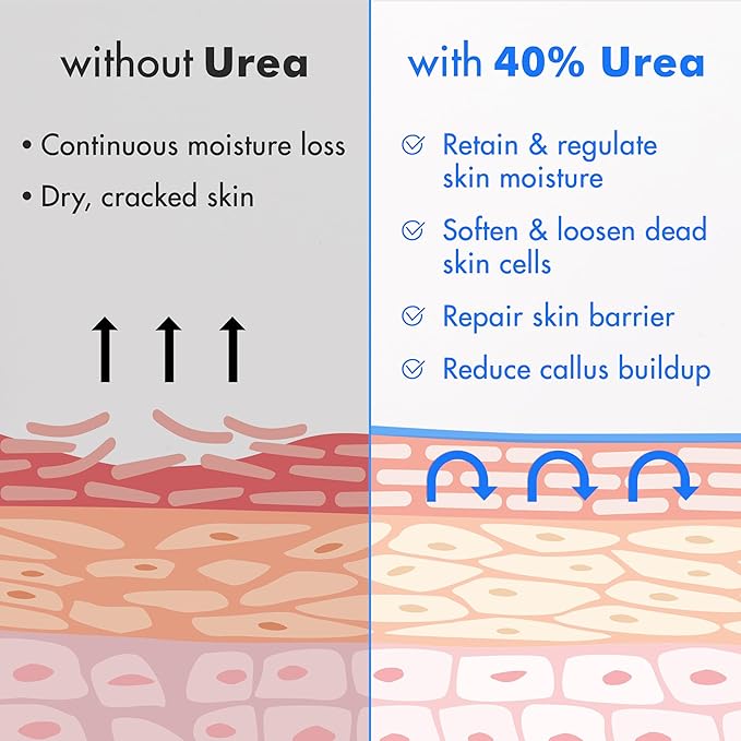 Ebanel Urea Cream 40% plus Salicylic Acid 2%, Foot Cream for Dry Cracked Heels Feet Knees Elbows Hands, Foot Dead Skin Cuticle Callus Remover Toenail Softener, Keratolytic Skin Barrier Repair