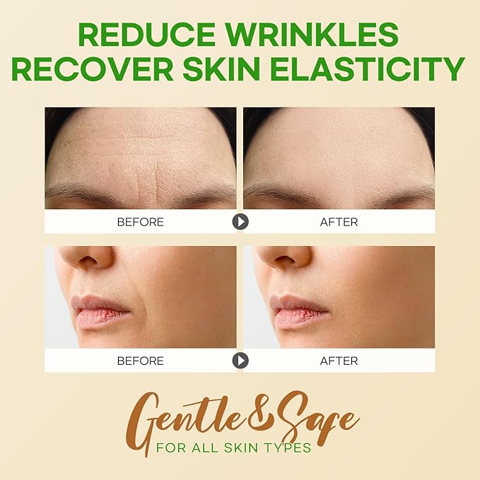 Forehead Wrinkle Patches 12Pcs with Smile Line Patches 24Pcs with Aloe, Collagen, Vitamin E, Forehead Wrinkles Treatment and Smile Lines Treatment
