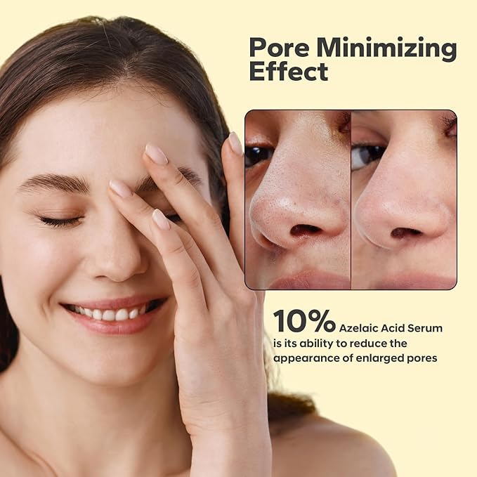 10% Azelaic Acid Serum (1 Fl Oz), Niacinamide Infused Skin Care for Face, Pore Minimizing, Redness Relief, Reduce Cystic Acne Scar, Blemish Control Serum