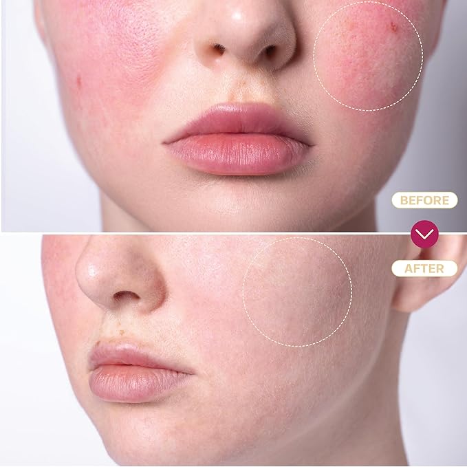 BASE LABORATORIES Hypochlorous Acid Spray for Face & Skin | 8oz | Magic Facial Spray Daily Skin Repair Solution for Sensitive Skin, Redness, Irritations, Eczema | Hypochlrous HOCL Molecule Spray | 2PK