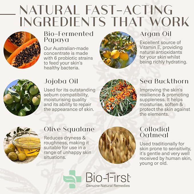 Ultrasensitive Skin Rescue Lotion - Body & Face Moisturizer - Hydrating Skin Care Rosacea, Rashes, or Dry, Itchy Skin - pH Balanced - Non-Toxic - Hypoallergenic - 3.38 oz