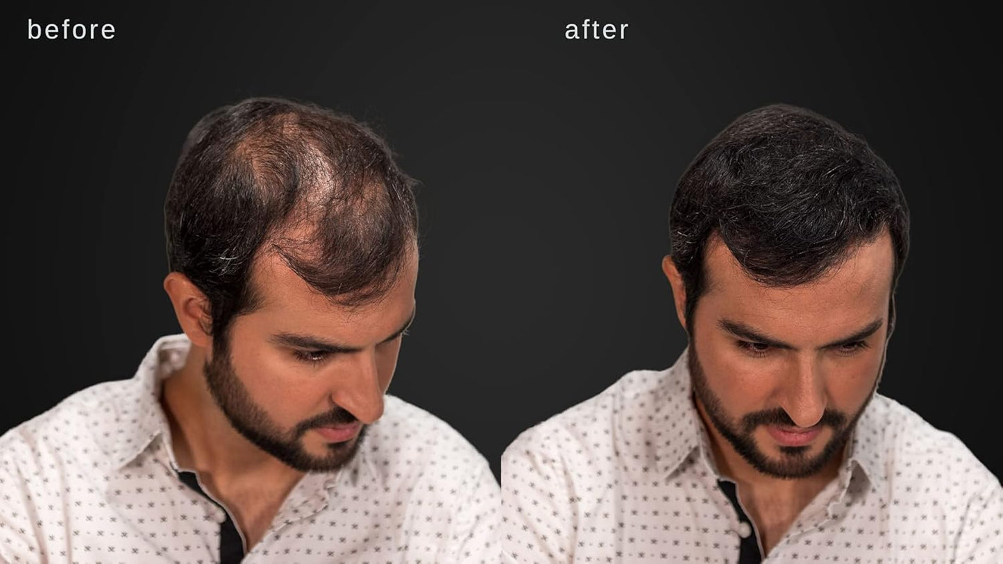 LUXE Hair Building Fibers - Thickening Fibers - CONFIDENCE IN A JAR – 2 Months+ Supply! – Hypoallergenic, Dermatologist Tested – Multiple Colors Available (Medium Blond)