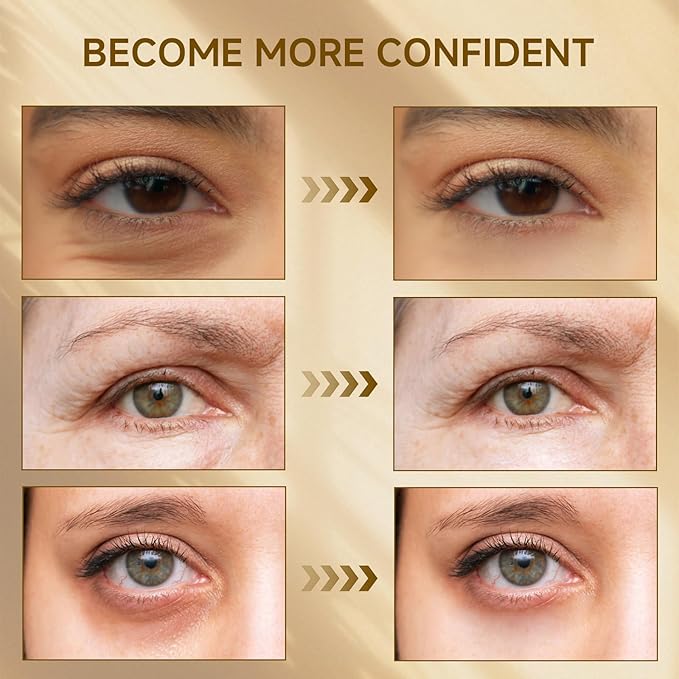 Instant Eye Tightener, Under Eye Bags and Wrinkles Filler, Temporary Instant Visibly Reduces Wrinkles Dark Circles Fine Lines Tightening and Lifting Cream for Women Men, 30ml