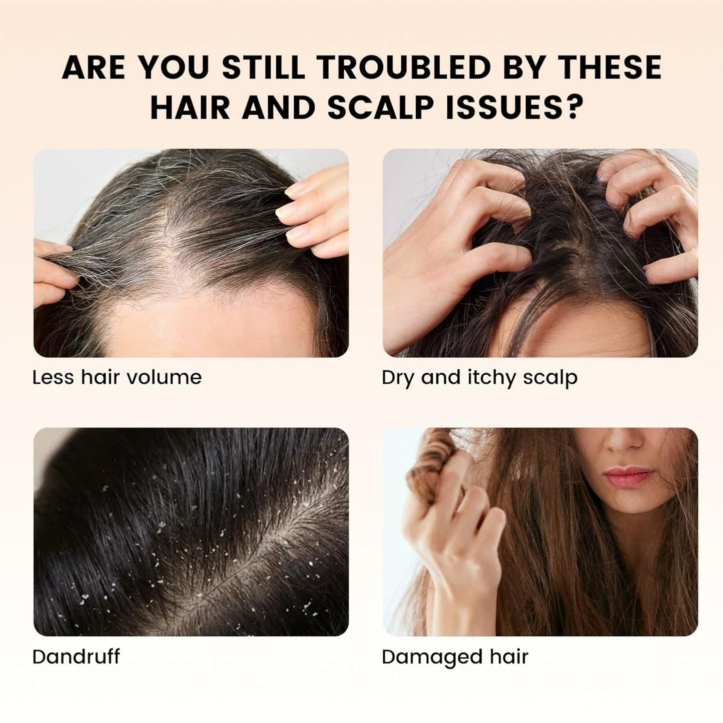 Rosemary & Fenugreek Hair Oil for Hair Growth, Volumizing & Strengthening - All Hair Types | Natural Nourishing Formula 120mL