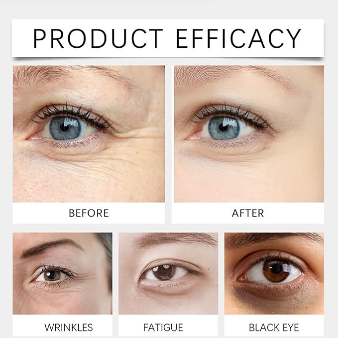 Dinkiss Lutein Eye Essence Oil, Vitamin C Lutein Eye Essence Oil, Improve Bags and Dark Circles, for Women Men (1, 3 pcs)