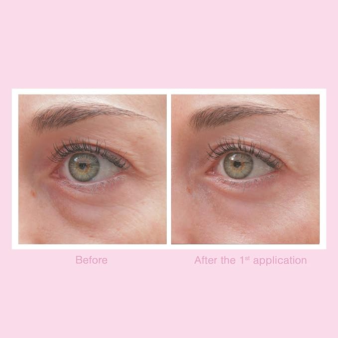 Illuminating Eye Cream - Anti-Aging, Hydrating & Brightening Treatment with Hyaluronic Acid, Vitamin C, and Essential Oils - Reduces Dark Circles, Fine Lines & Puffiness - All Skin Types