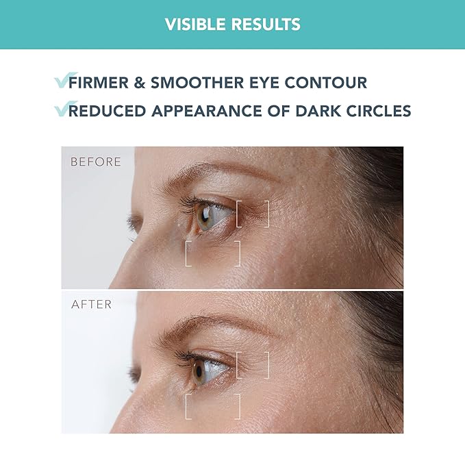 Foreo IRIS Firming PM Eye Serum - Retinol - Mushroom Extract - Vitamin E - Bakuchiol - Travel size Treatment Products - Dark Circles & Bags - Fragrance Free - All Skin Types - 0.5 oz