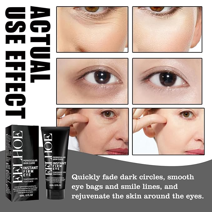 EELHOE Instant Eye Tightener, Tightener Cream for Under Eye Bags, Temporary Firm & Reduce Dark Circles, Puffiness, Fine Lines, 2 Fl.Oz