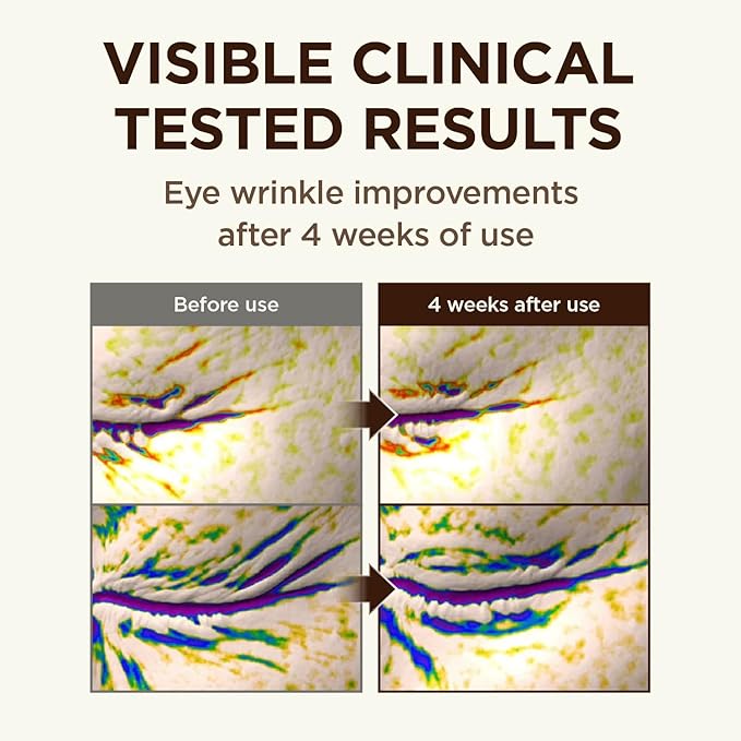 CKD Retinal 5X Gua Sha Eye Cream - Anti-Aging Eye Moisturizer for Wrinkles, Dark Circles & Puffiness – Firming & Hydrating Under Eye Treatment with Retinal & Collagen. Korean Skincare. 1.01 fl oz.