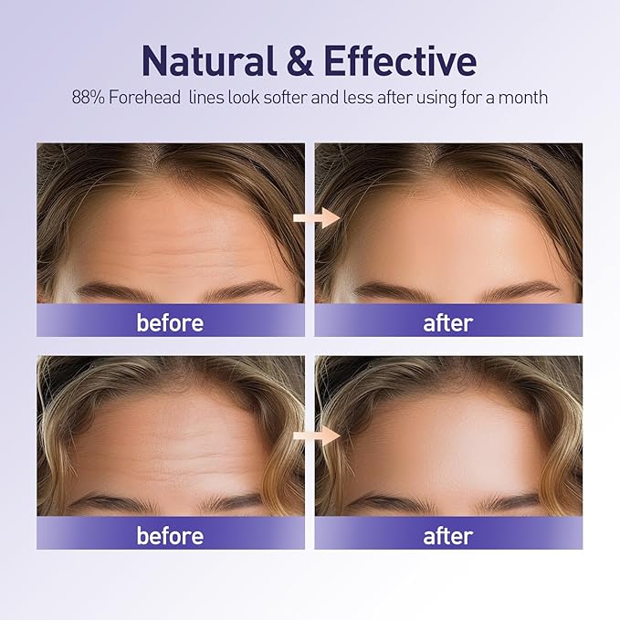 Soft Silicone Forehead Wrinkle Patches Reusable, Non-invasive Natural Forehead Wrinkles Treatment Patches, Safe Anti Wrinkle Facial Patches Overnight,4 Pieces