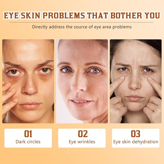 2Pcs Lumibalm For Under Eye Bags, Lumibalm Retinol Eye Serum, Deeply Moisturizes & Reduce Fine Lines (A)