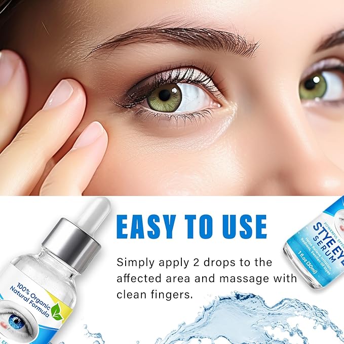 Stye Eye Treatment, Natural Stye Eye Relief Serum, for Styes Chalazion and Blepharitis Treatment, Restored Healthier Eye Skin, Blue