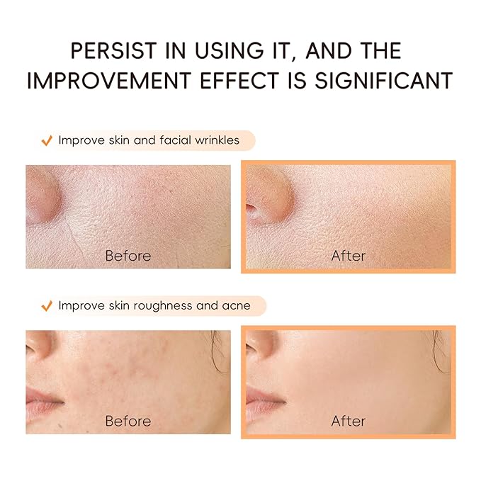 Snail Mucin Cream, 97.5% Pure Snail Slime Extract Moisturizer for Face and Body, Snail Mucin Essence 92% Snail Slime Serum, Face Cleanser for Moisturizing Repairing