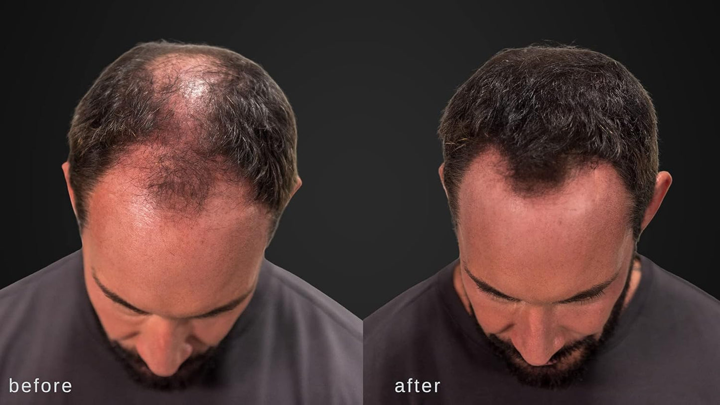 LUXE Hair Building Fibers - Thickening Fibers - CONFIDENCE IN A JAR – 2 Months+ Supply! – Hypoallergenic, Dermatologist Tested – Multiple Colors Available (Medium Blond)