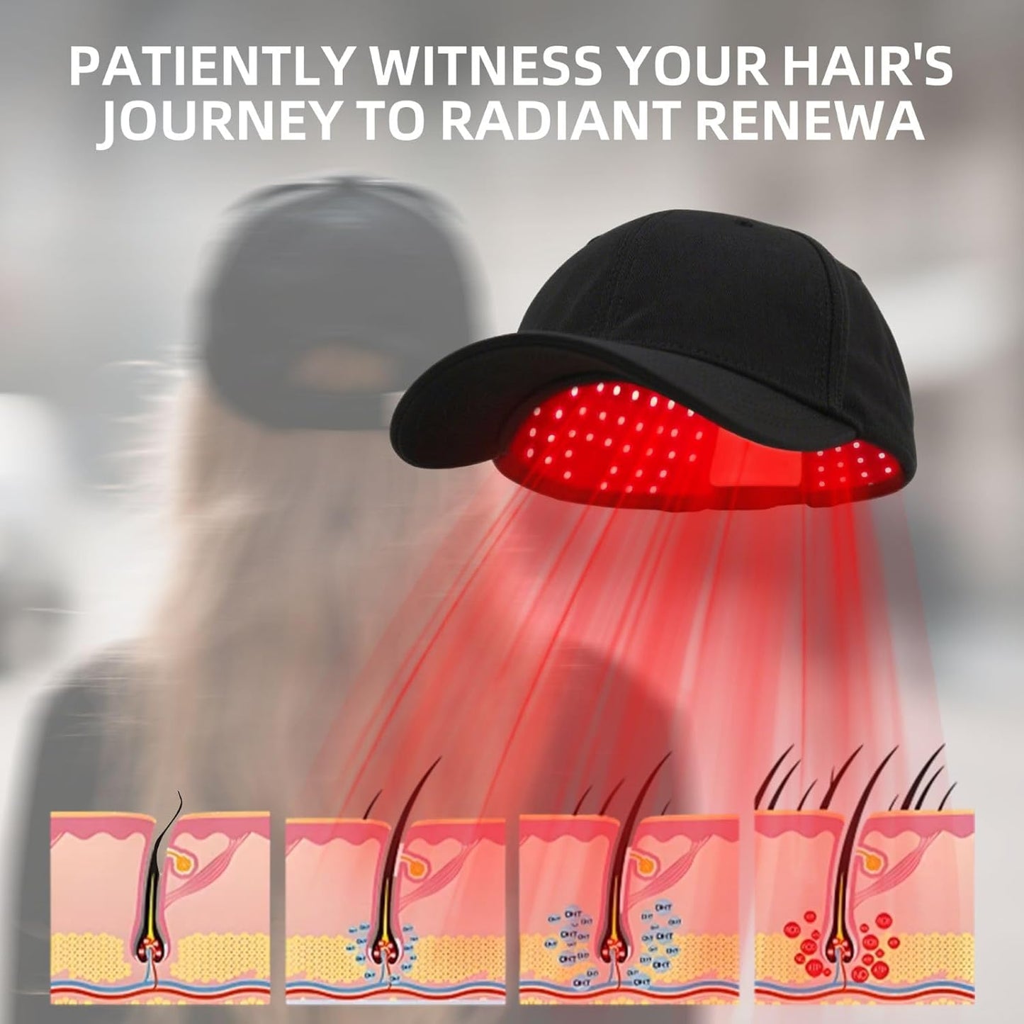 Red Light Therapy for Hair Growth, Laser Hair Loss Treatments Hat, Discreet Daily Use Under Hats, 20-min Rechargeable