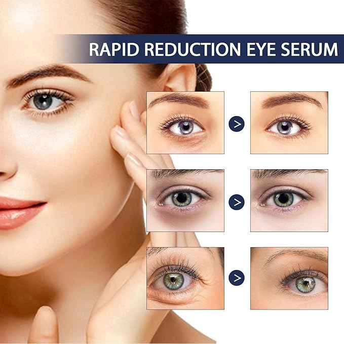 Rapid Reduction Eye Serum - Advanced Formula - Anti Aging Serum Visibly Reduces Under-Eye Bags-q2