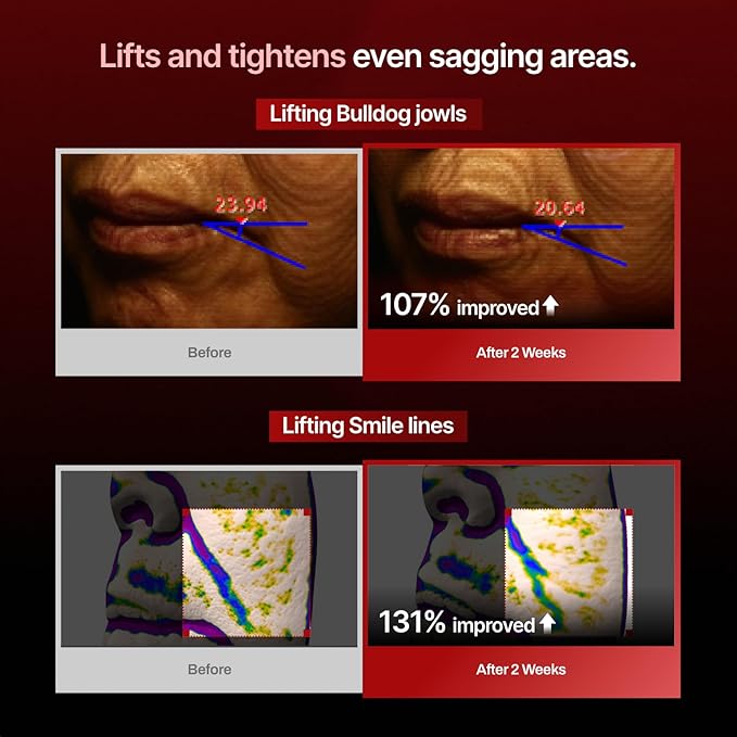 MEDITHERAPY Wrinkle-fit Mask + Facial Roller, Collagen Mask, Lifting Sagging Skin, Hydrating, Improving Elasticity, Glass Skin, Korean Skincare