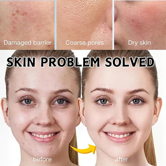 8pcs Animal Character Sheet Facial Masks - Face Masks Skincare Korean - Hydrating Face Masks - Korean Skin Care Mask - Hydrate,Soothe,Firm -Teen Girl Gift Easter Gifts for Women with Bunny Headband