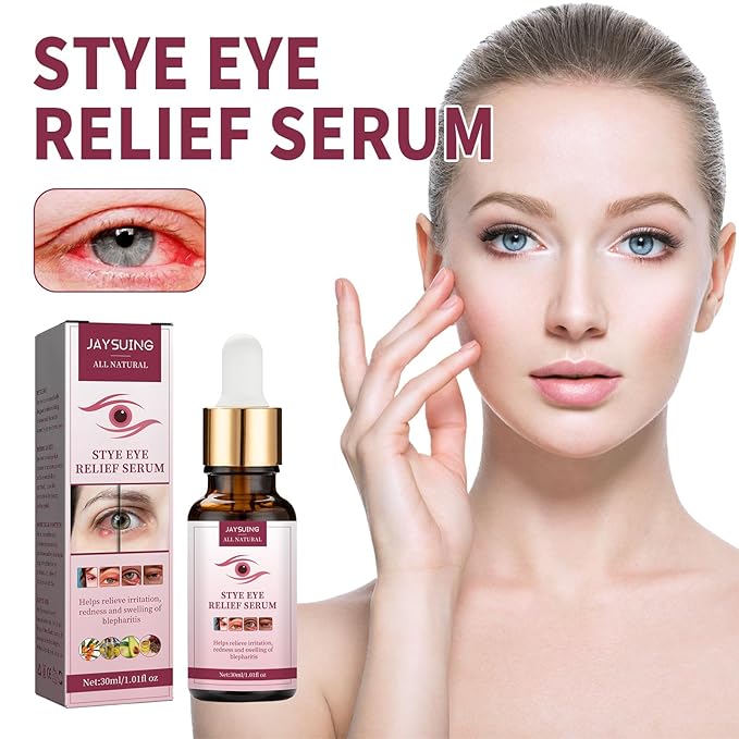 Stye Eye Treatment, Chalazion Remover, Gently Cleanses Lashes and Eyes, Restore Healthier Eye Skin