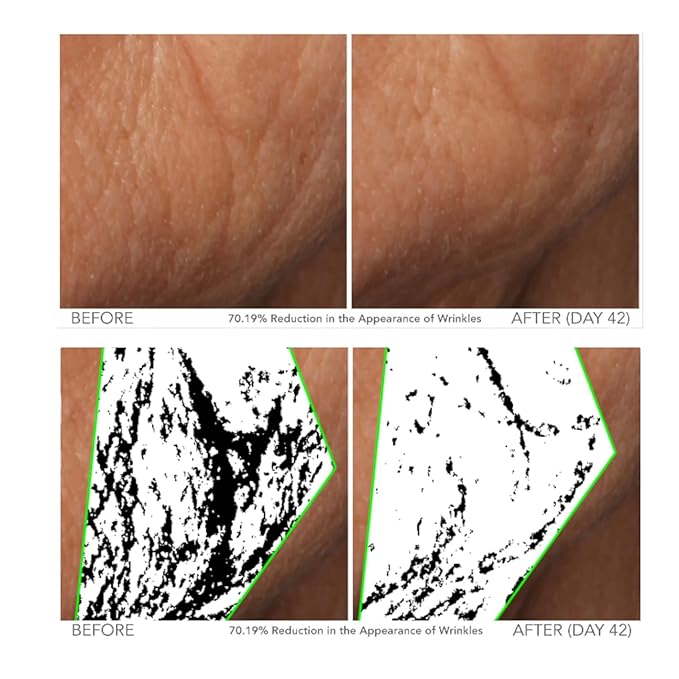 Serious Skincare - Beyond Intensive Vitamin C Serum for Face & Neck - 60 Day Facial Treatment to Brighten & Revive Glow - Visibly Smooth Lines, Wrinkles and Pores - AM & PM 2 Piece Skin Care Set