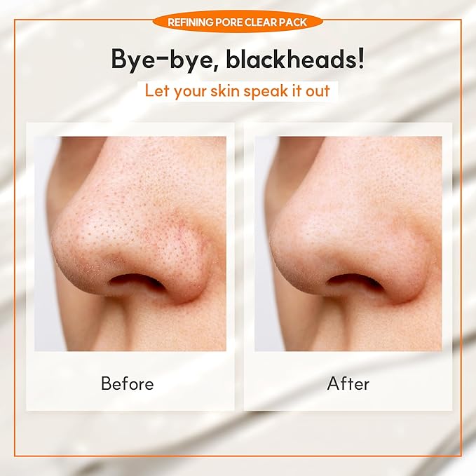 Refining Pore Clear Pack | Clay Face Mask | Pore Cleanser | Wash Off Mask Type | Hydrating Facial Mask for All Skin Types | Korean Beauty Skincare Product (150g/5.29 Oz.)