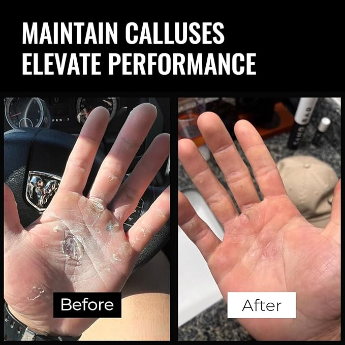 SandBar Original Callus File - Callus Remover for Hands and Fingers - Don't Remove Hard Skin with Shavers Or Pumice Stones - Maintain Your Grip - for Gym Enthusiasts, Climbers, Gymnasts & WOD Junkies