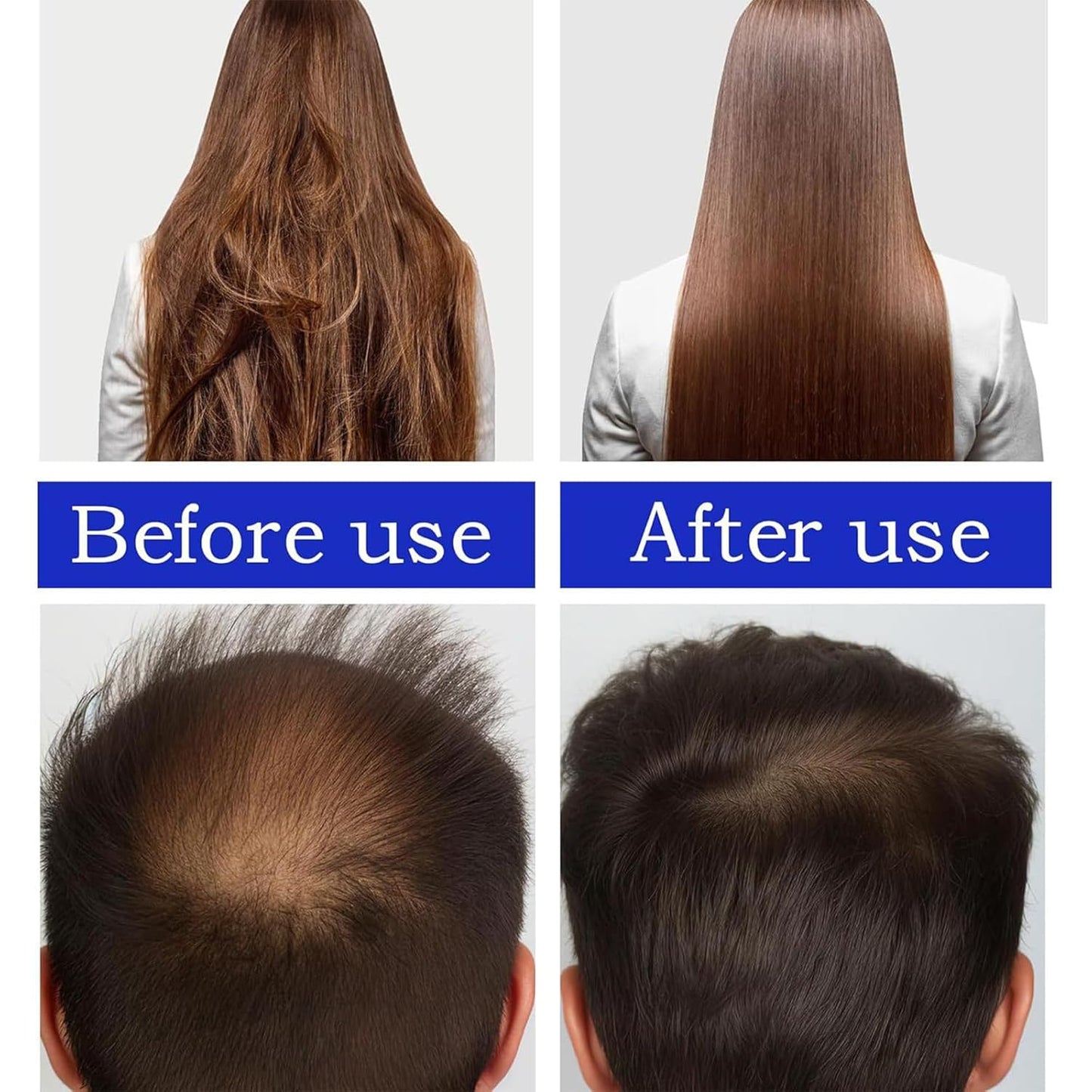 100% & Unrefined Pure Batana Miracle Oil for Smoother Hair Growth - from Honduras, Repairs Damaged Hair & Hair Loss, 2 oz