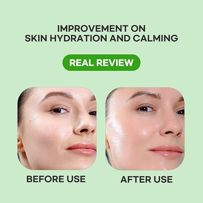 Epielle Heartleaf Calming Serum Sheet Masks (5pk) | Korean Skincare | Facial Sheet Mask | Kbeauty, Mother's Day Gifts