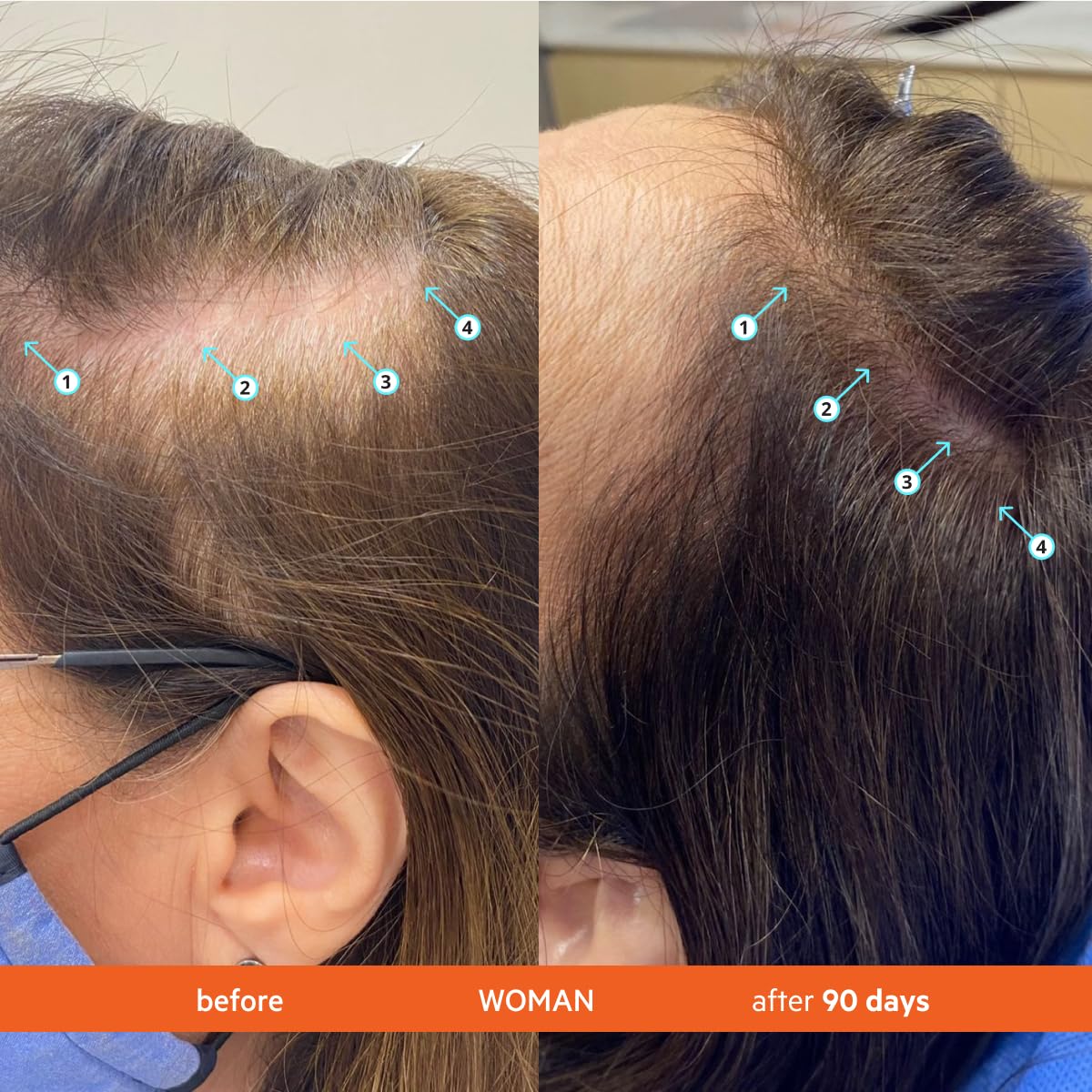 DS Labs Revita Shampoo, 500 mL – Scalp Refreshing Cleanse for Fuller Looking, Volumizing, Lightweight Hydration, Sulfate & Silicone Free, Color Safe, For Men & Women