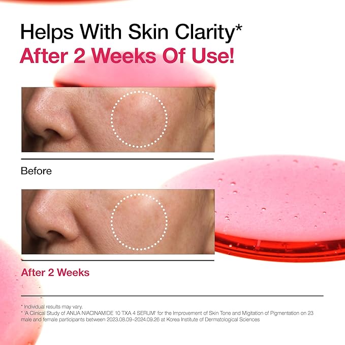 ANUA Niacinamide 10 + TXA 4 Serum, Hyaluronic Acid, Tranexamic acid, Vitamin B12, Facial Serum for Glass Skin, Clarifying, Radiant Complexion with Natural Color, Korean Skin Care (30ml /1.01 fl.oz)