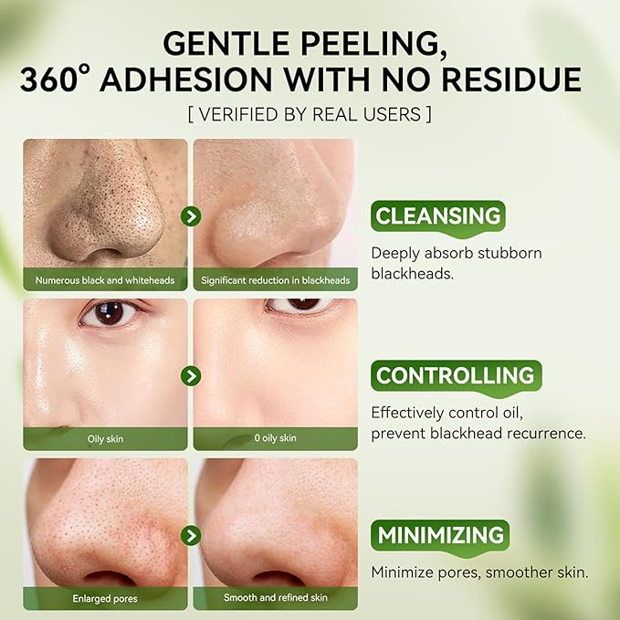 LANBENA Nose Pore Strips, 2pcs, 2% BHA(Salicylic Acid) Blackheads Remover Peel off Mask, Plants Pore Cleanser Purifying Face Mask, Unclog Pores, Oil Control, Upgraded 2.0 added Amazonian White Clay