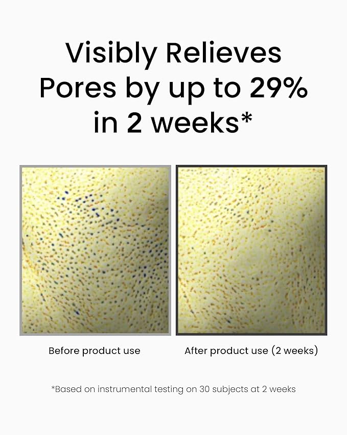 Korean Retinol Serum for Face (1fl oz) – Youth Rejuvenating Face Ampoule for Improving Fine Lines & Reducing Pigmentation, Skin Care for Day & Night Use. Vitamin C, Niacinamide, Peptide