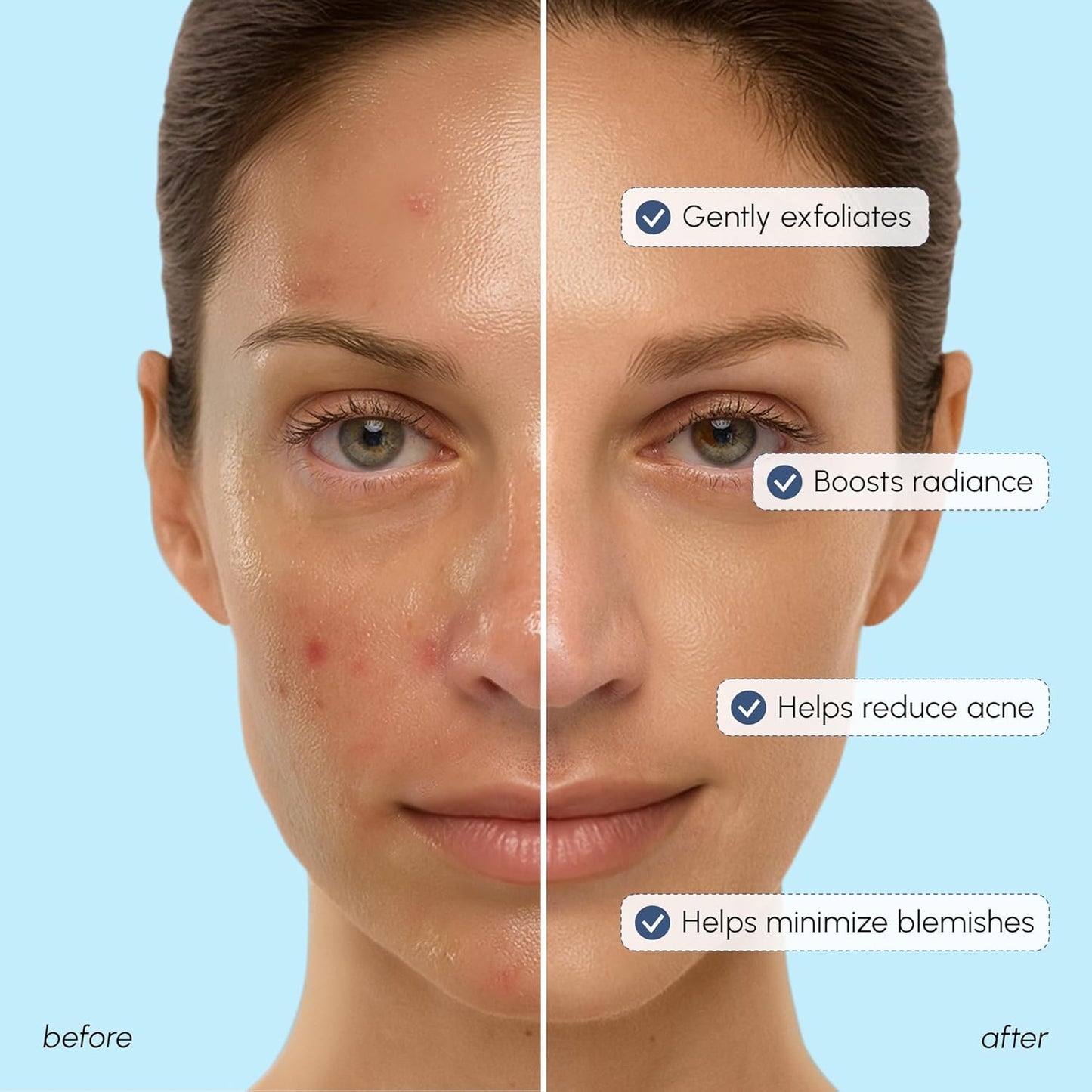 MAREE Glycolic Acid Toner 10% - Exfoliating Toner for Face - Glycolic Acid Face Exfoliator - Face, Scalp & Underarms Exfoliant Spray Alternative - Facial Toner for Women - Acido Glicolico para Manchas