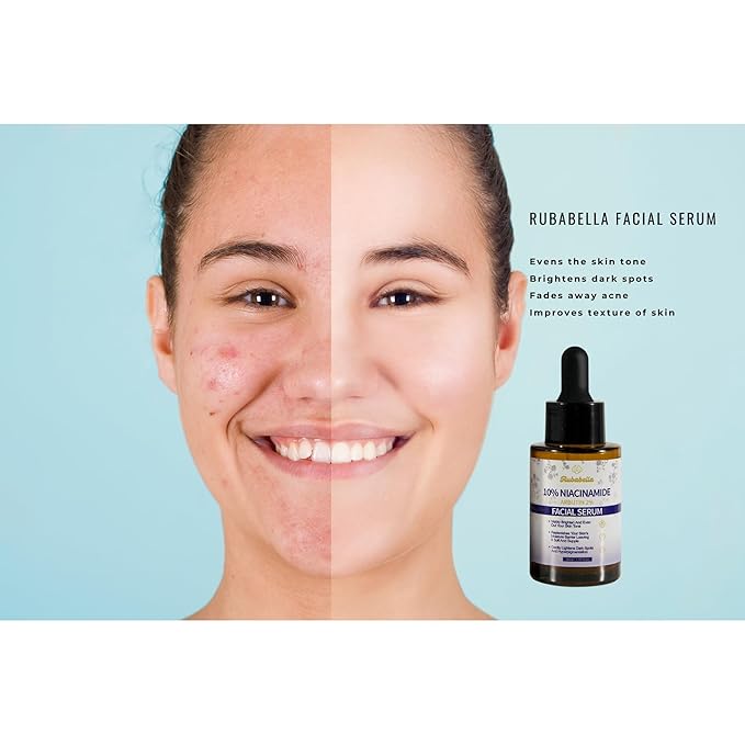 10% Niacinamide Arbutin 2% Face Serum for Acne Control | Pore Minimizer for Face | Antiaging | Clears Acne Marks & Blemishes for Even Skin Tone | For Women & Men | 1 Fl Oz / 30 ml