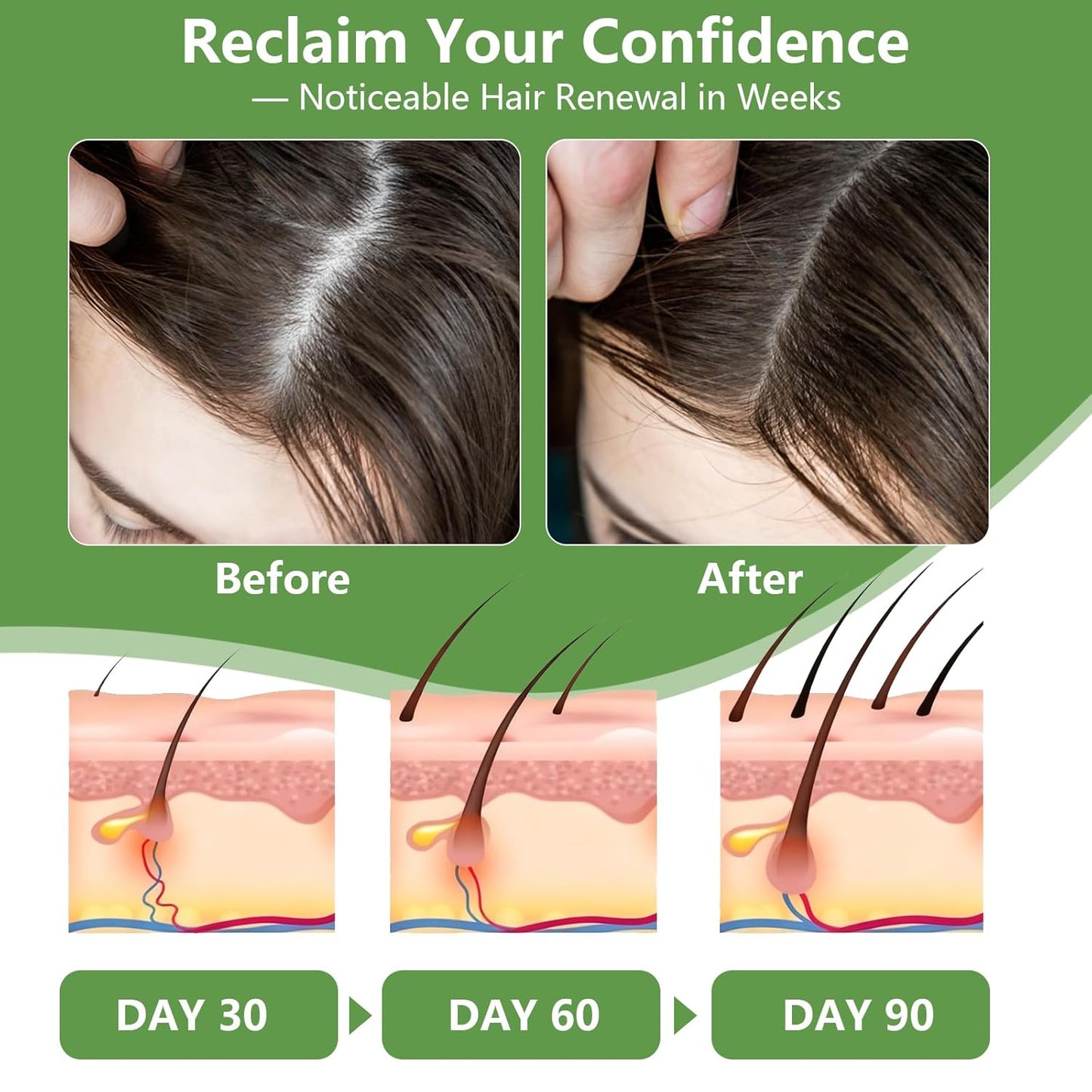 Batana Oil for Hair Growth – 100% Pure Raw Organic Hair Oil from Nature –Deep Repair Hair Treatment for Men and Women to Prevent Hair Loss & Enhance Thickness (4.2oz)