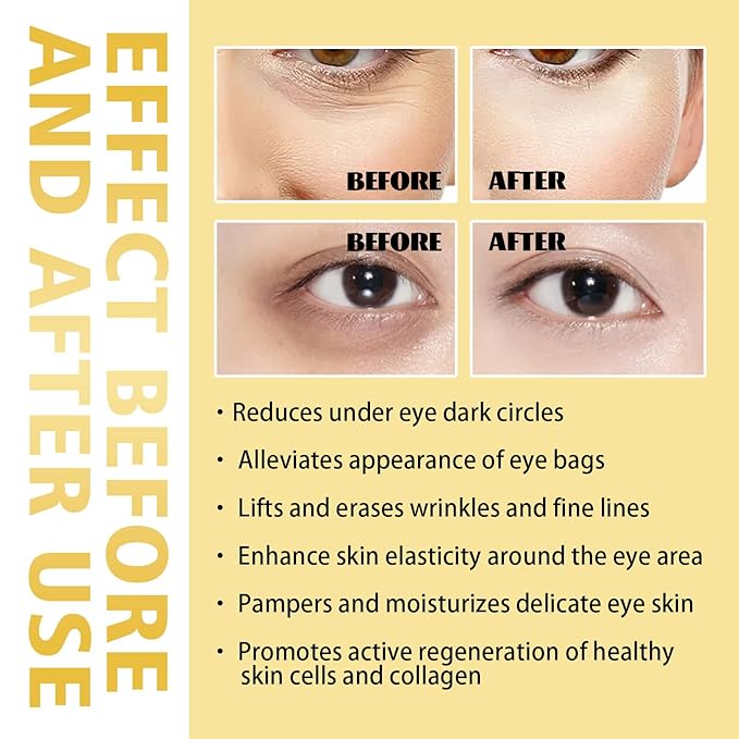 Rollerball Castor Oil And Frankincense, 10 ML Castor Oil And Frankincense Eye Roller, Castor Oil Frankincense Rollerball Under Eye, Castor Oil Roller Ball (3pcs)