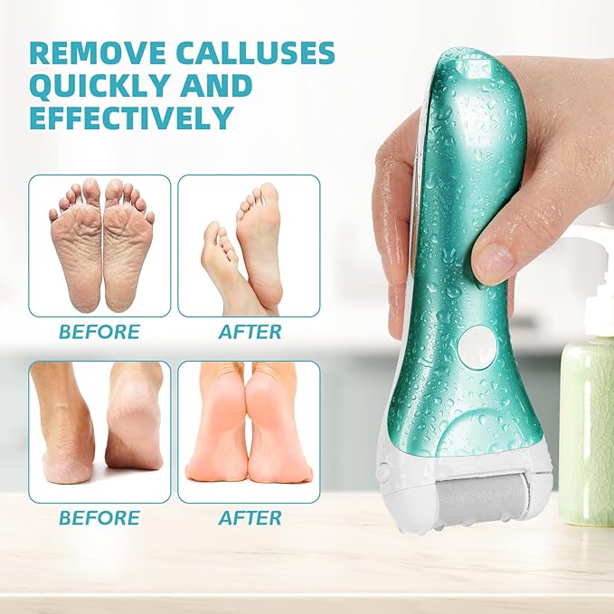 Callus Remover for Feet, Nicebirdie Electric Foot File Callus Removers Rechargeable Waterproof Pedicure Tools Foot Scrubber Shaver Feet Care Tool for Cracked Heels Dead Skin （Green）