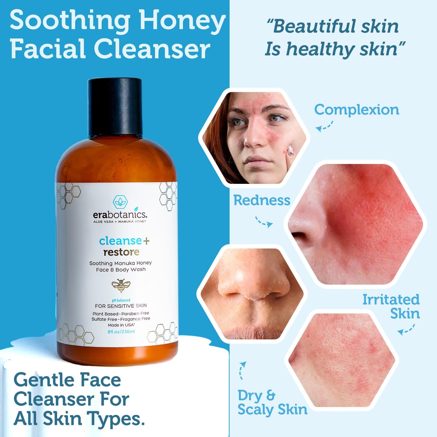 Era Organics Manuka Honey Face Wash for Sensitive Skin - Sulfate Free Gentle Cleanser with Organic Aloe Vera, Hyaluronic Acid & More - Soothing & Moisturizing for Dry Skin - Made in USA (4 oz)